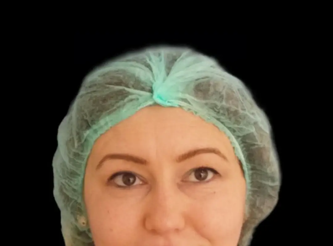 Blepharoplasty Before